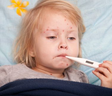Trẻ Bị Thủy Đậu Cần Chăm Sóc Như Thế Nào?